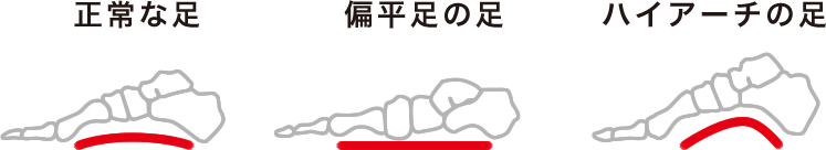 正常な足　偏平足な足　ハイアーチな足