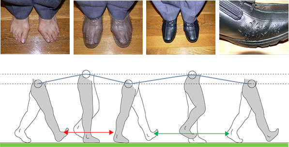 靴に気をつけて外反母趾を予防