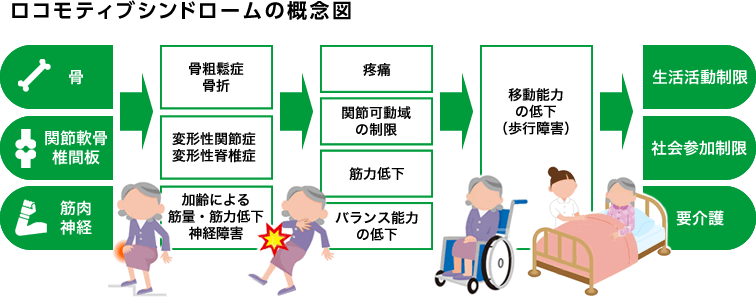 ロコモティブシンドロームの概念図