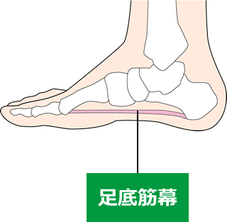 ⑩足底腱膜炎