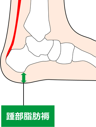 ⑪踵部脂肪褥炎