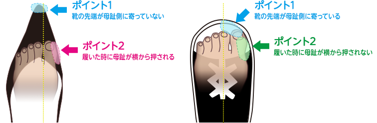 母趾を外側に曲げない靴選びのポイント