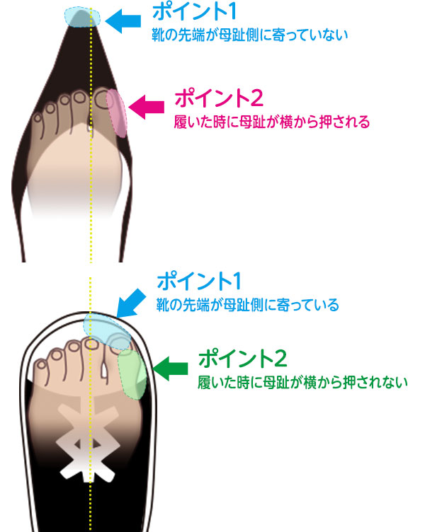 ポイント1、ポイント2