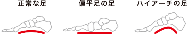 横のアーチ　正常な足　開帳足