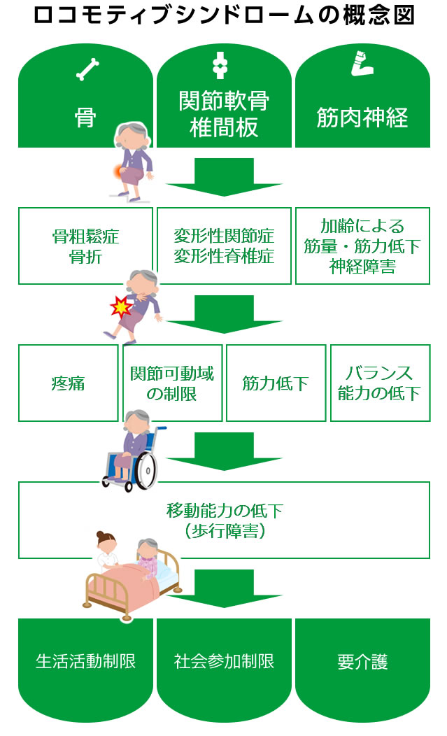 ロコモティブ・シンドロームとは