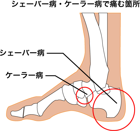 歩行の歴史