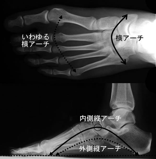 効率の良い歩行