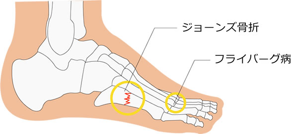 刺激の強さと体の反応