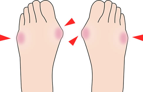 足裏が痛まない靴を開発中