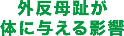 外反母趾が体に与える影響