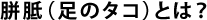 胼胝(足のタコ)とは?