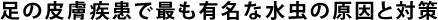 足の皮膚疾患で最も有名な水虫の原因と対策